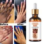 Joint Melanin Removal Serum – Lighten Black Knees & Ankles, Brighten Skin, Armpit Whitening