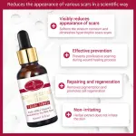 Aichun Beauty Removal Body Scar Serum