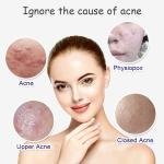 Aichun Beauty Salicylic Acid Face Serum