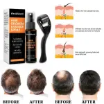 Eelhoe Hair Growth Essence Spray