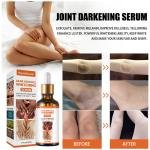 Joint Melanin Removal Serum – Lighten Black Knees & Ankles, Brighten Skin, Armpit Whitening