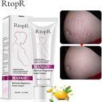 Rtopr Mango Remove Pregnancy Scars Cream