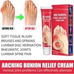 South Moon Bunions Pain Relief Cream