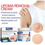 South Moon Lipoma Removal Cream